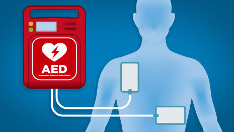 醫用護理床：黃金搶救4分鐘，使用CPR，AED指南！